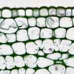 草本雙子葉植物莖:老Richinus的皮質厚壁組織