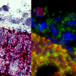 RNA原位雜交-人黑色素瘤FFPE組織切片(KRT5和管家基因)