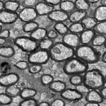 軸突的代表性電子顯微照片，準備測量髓磷脂厚度